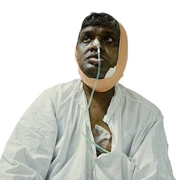 Illustrative image representing the kind of people NEVYA works to support
