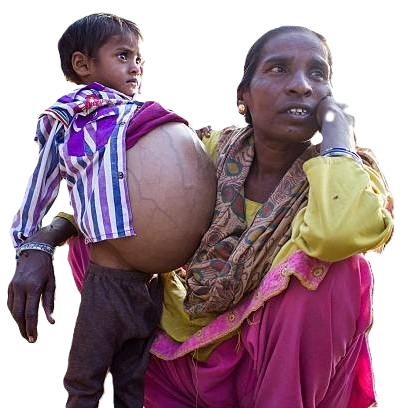 Illustrative image representing the kind of people NEVYA works to support
